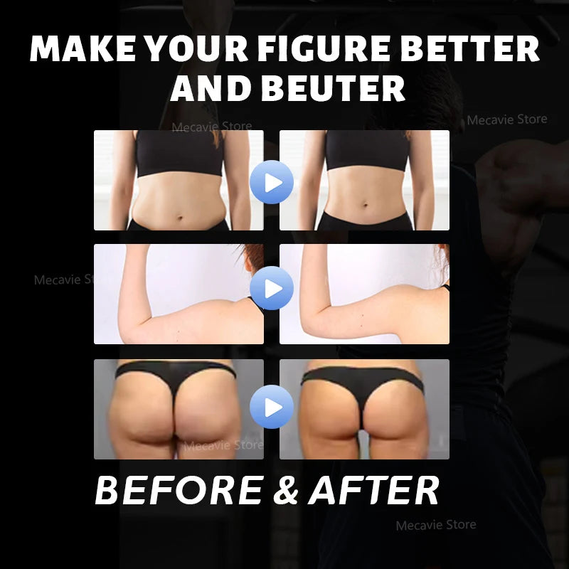 EMSnova Sculpt EMS RF Body Shaping Device Muscle Stimulator Fat Burning Electromagnetic Therapy Equipment for Fitness Centers